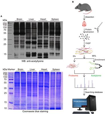 A comprehensive mouse brain acetylome-the cellular-specific distribution of acetylated brain proteins